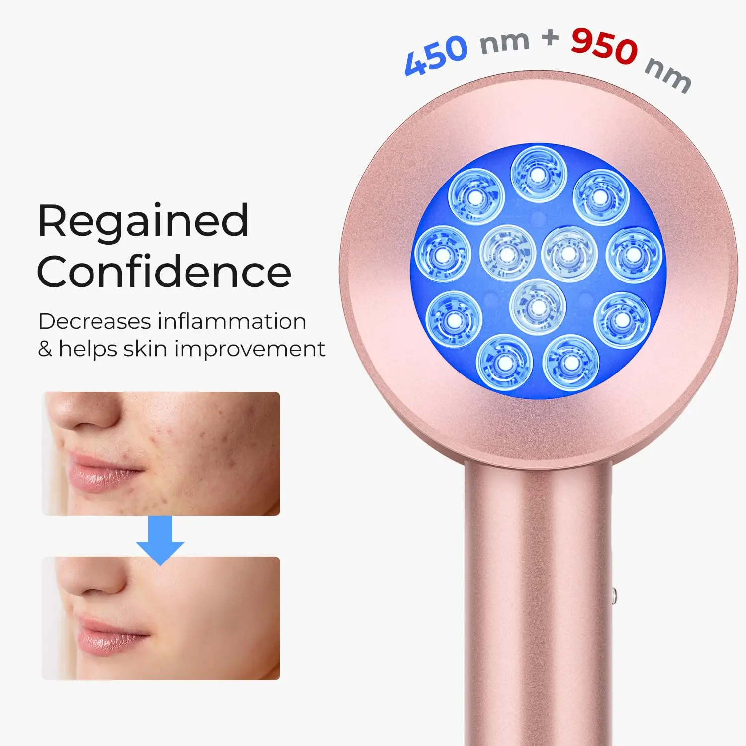 Skin Care Red Light Therapy- Anti Aging Infrared Lamp- Facial Beauty Device- Anti-Acne, Wrinkle Remover Device